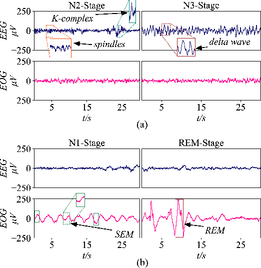 Figure 1 for SalientSleepNet: Multimodal Salient Wave Detection Network for Sleep Staging
