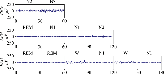 Figure 3 for SalientSleepNet: Multimodal Salient Wave Detection Network for Sleep Staging