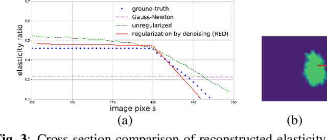 Figure 3 for Combining physics-based modeling and deep learning for ultrasound elastography