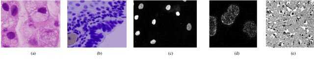 Figure 3 for Neuroplastic graph attention networks for nuclei segmentation in histopathology images