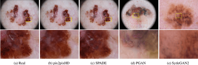 Figure 2 for GAN-Based Data Augmentation and Anonymization for Skin-Lesion Analysis: A Critical Review