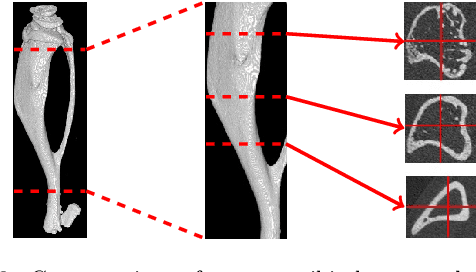 Figure 3 for ChronoMID - Cross-Modal Neural Networks for 3-D Temporal Medical Imaging Data
