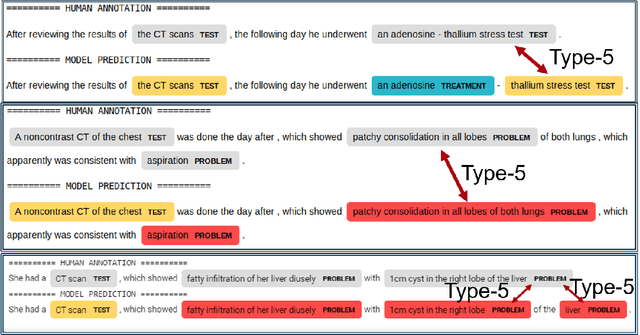 Figure 1 for Extensive Error Analysis and a Learning-Based Evaluation of Medical Entity Recognition Systems to Approximate User Experience