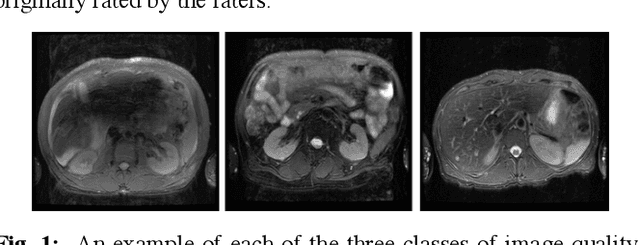 Figure 1 for Diagnostic Image Quality Assessment and Classification in Medical Imaging: Opportunities and Challenges