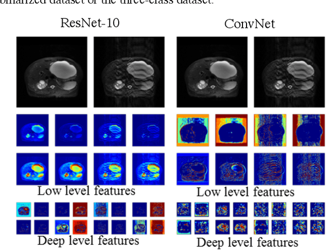 Figure 3 for Diagnostic Image Quality Assessment and Classification in Medical Imaging: Opportunities and Challenges