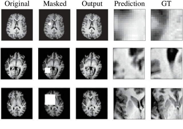 Figure 3 for Unsupervised Region-based Anomaly Detection in Brain MRI with Adversarial Image Inpainting