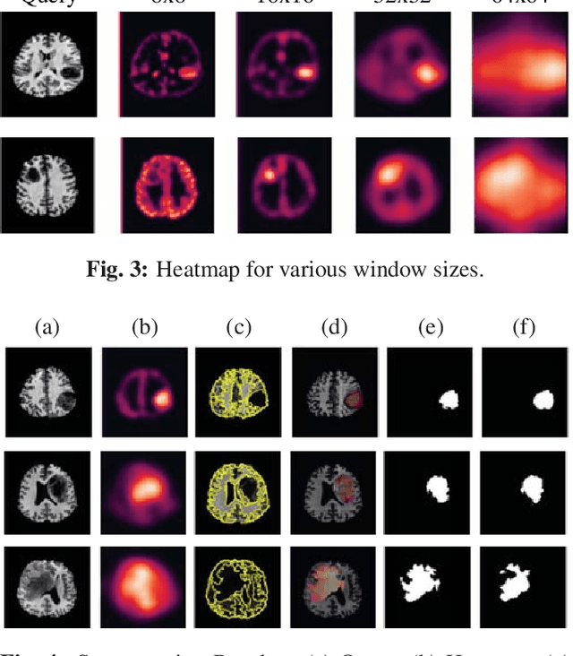 Figure 4 for Unsupervised Region-based Anomaly Detection in Brain MRI with Adversarial Image Inpainting