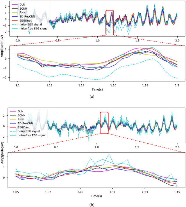 Figure 4 for EEGDnet: Fusing Non-Local and Local Self-Similarity for 1-D EEG Signal Denoising with 2-D Transformer