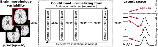 Figure 1 for Bidirectional Modeling and Analysis of Brain Aging with Normalizing Flows