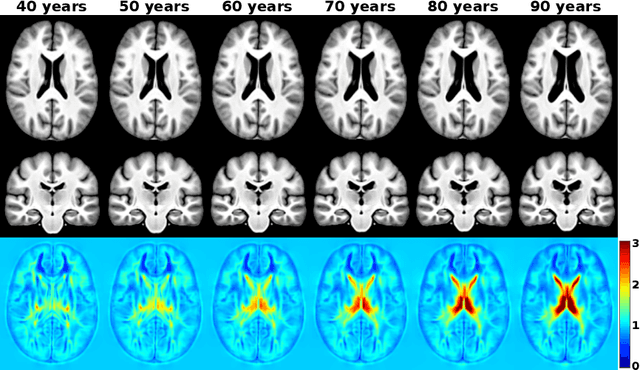 Figure 3 for Bidirectional Modeling and Analysis of Brain Aging with Normalizing Flows
