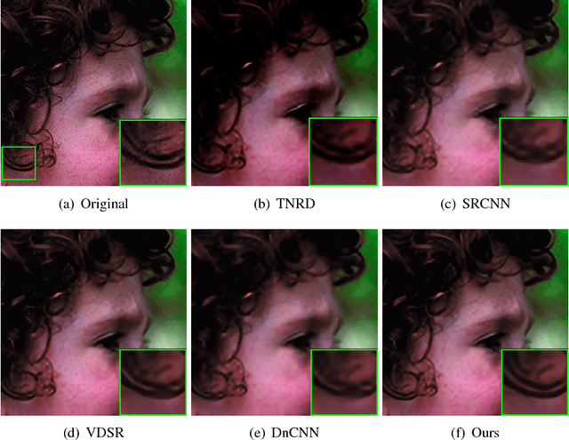 Figure 2 for Denoising Prior Driven Deep Neural Network for Image Restoration