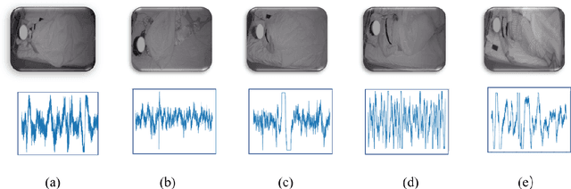 Figure 2 for Seeing your sleep stage: cross-modal distillation from EEG to infrared video