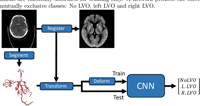 Figure 1 for Detection of Large Vessel Occlusions using Deep Learning by Deforming Vessel Tree Segmentations