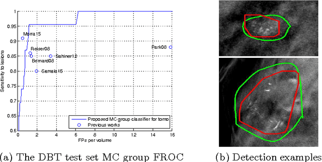 Figure 4 for Transferring Learned Microcalcification Group Detection from 2D Mammography to 3D Digital Breast Tomosynthesis Using a Hierarchical Model and Scope-based Normalization Features