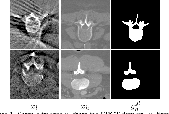 Figure 1 for Joint Unsupervised Learning for the Vertebra Segmentation, Artifact Reduction and Modality Translation of CBCT Images