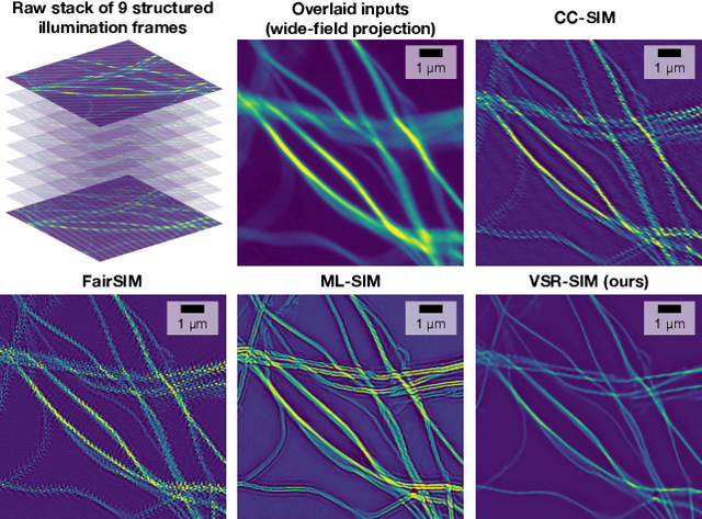 Figure 1 for Spatio-temporal Vision Transformer for Super-resolution Microscopy