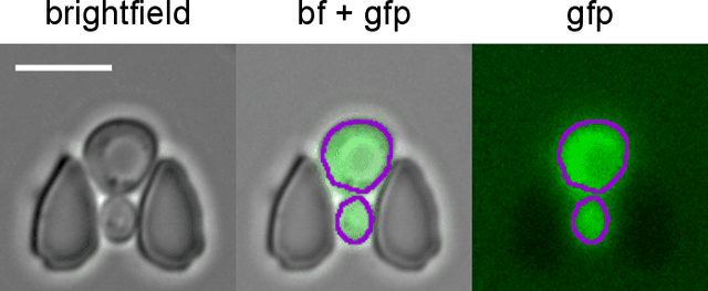 Figure 3 for Multiclass Yeast Segmentation in Microstructured Environments with Deep Learning