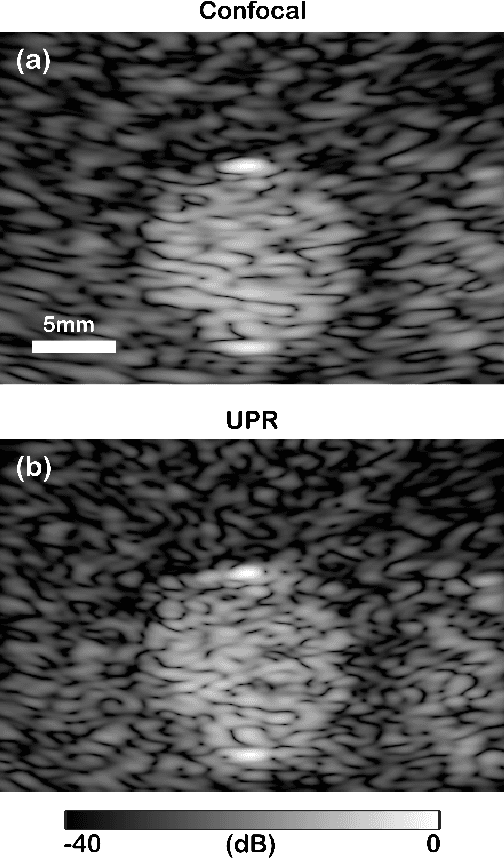 Figure 4 for Pixel-reassignment in Ultrasound Imaging