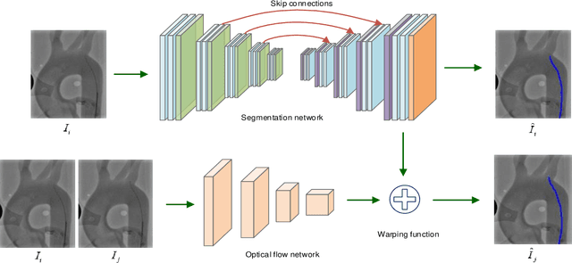 Figure 3 for End-to-End Real-time Catheter Segmentation with Optical Flow-Guided Warping during Endovascular Intervention