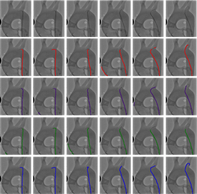 Figure 4 for End-to-End Real-time Catheter Segmentation with Optical Flow-Guided Warping during Endovascular Intervention