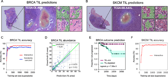 Figure 2 for HistomicsML2.0: Fast interactive machine learning for whole slide imaging data