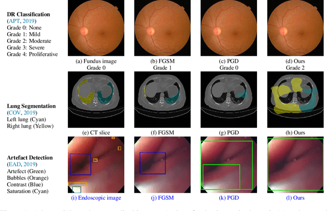 Figure 1 for Stabilized Medical Image Attacks