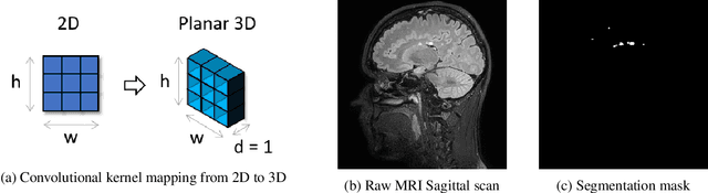 Figure 1 for Planar 3D Transfer Learning for End to End Unimodal MRI Unbalanced Data Segmentation