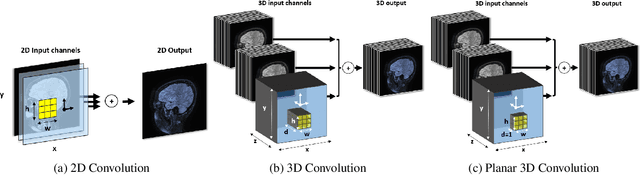 Figure 3 for Planar 3D Transfer Learning for End to End Unimodal MRI Unbalanced Data Segmentation