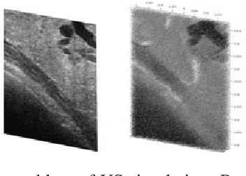 Figure 1 for SCATGAN for Reconstruction of Ultrasound Scatterers Using Generative Adversarial Networks