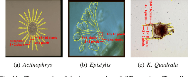 Figure 3 for A Multi-scale CNN-CRF Framework for Environmental Microorganism Image Segmentation