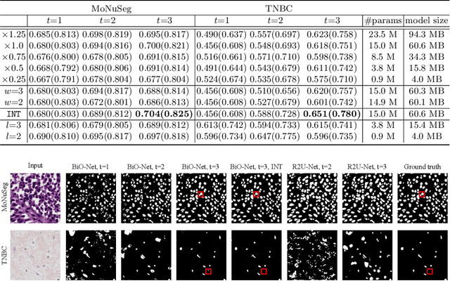 Figure 4 for BiO-Net: Learning Recurrent Bi-directional Connections for Encoder-Decoder Architecture