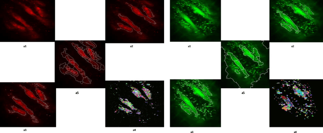 Figure 2 for An Automatic Seeded Region Growing for 2D Biomedical Image Segmentation