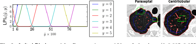 Figure 3 for Deep Learning from Label Proportions for Emphysema Quantification