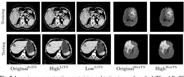 Figure 3 for Data Stealing Attack on Medical Images: Is it Safe to Export Networks from Data Lakes?