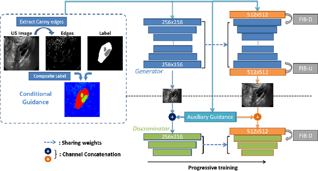 Figure 3 for Synthesis and Edition of Ultrasound Images via Sketch Guided Progressive Growing GANs