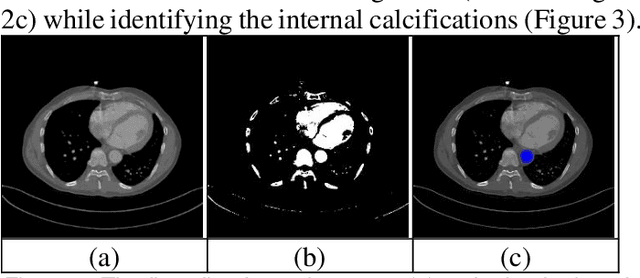 Figure 2 for Automated Analysis of Femoral Artery Calcification Using Machine Learning Techniques