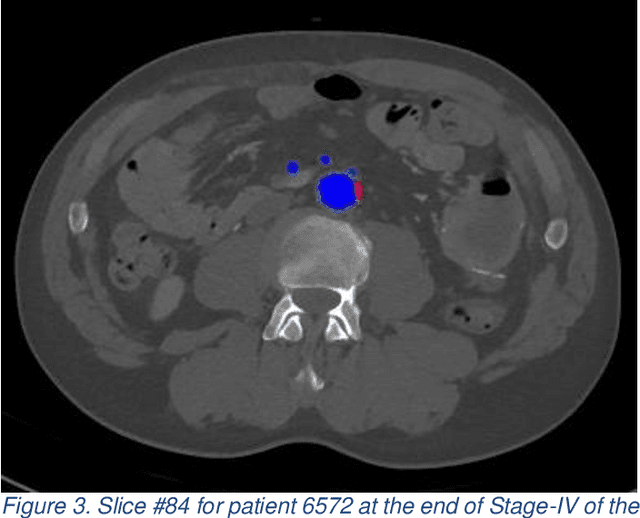 Figure 3 for Automated Analysis of Femoral Artery Calcification Using Machine Learning Techniques