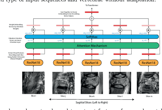 Figure 1 for Context-Aware Transformers For Spinal Cancer Detection and Radiological Grading