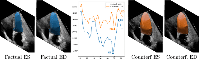 Figure 4 for D'ARTAGNAN: Counterfactual Video Generation