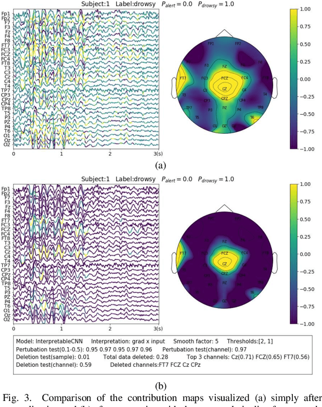 Figure 3 for Towards Best Practice of Interpreting Deep Learning Models for EEG-based Brain Computer Interfaces