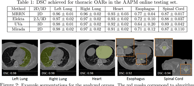 Figure 2 for Multiple resolution residual network for automatic thoracic organs-at-risk segmentation from CT