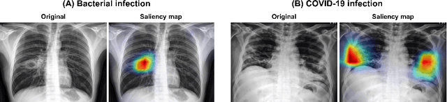Figure 4 for Vision Transformer for COVID-19 CXR Diagnosis using Chest X-ray Feature Corpus