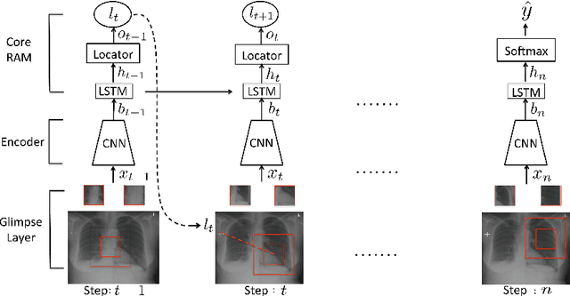 Figure 1 for Learning what to look in chest X-rays with a recurrent visual attention model