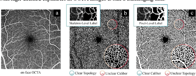 Figure 1 for Label Adversarial Learning for Skeleton-level to Pixel-level Adjustable Vessel Segmentation