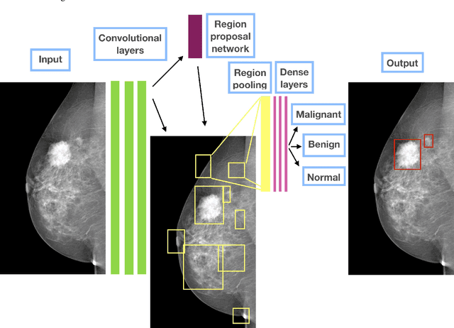 Figure 1 for Detecting and classifying lesions in mammograms with Deep Learning