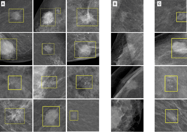 Figure 4 for Detecting and classifying lesions in mammograms with Deep Learning