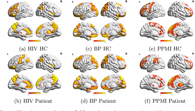 Figure 3 for Interpretable Graph Neural Networks for Connectome-Based Brain Disorder Analysis