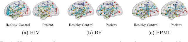 Figure 4 for Interpretable Graph Neural Networks for Connectome-Based Brain Disorder Analysis