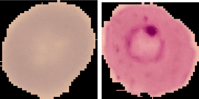 Figure 1 for CIDMP: Completely Interpretable Detection of Malaria Parasite in Red Blood Cells using Lower-dimensional Feature Space