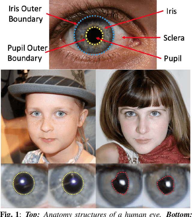 Figure 1 for Eyes Tell All: Irregular Pupil Shapes Reveal GAN-generated Faces